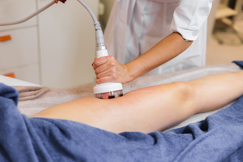 Non-Surgical Cellulite Treatments: Safe, Effective, and&nbsp;Long-Lasting